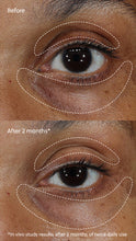 Load image into Gallery viewer, Vitamin C+ Eye Cream