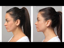 Load and play video in Gallery viewer, Acne Advanced Clarifying Masque